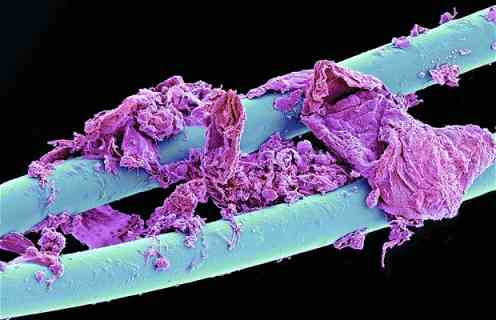 SEM-Scanning-Electron-Microscopic-Images-14