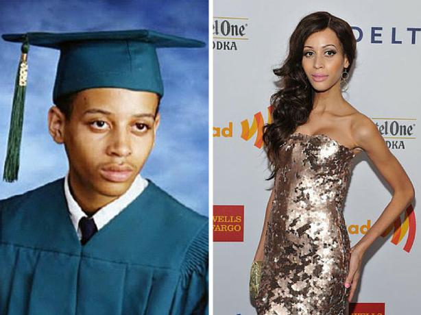 Transgender celebrity before and after