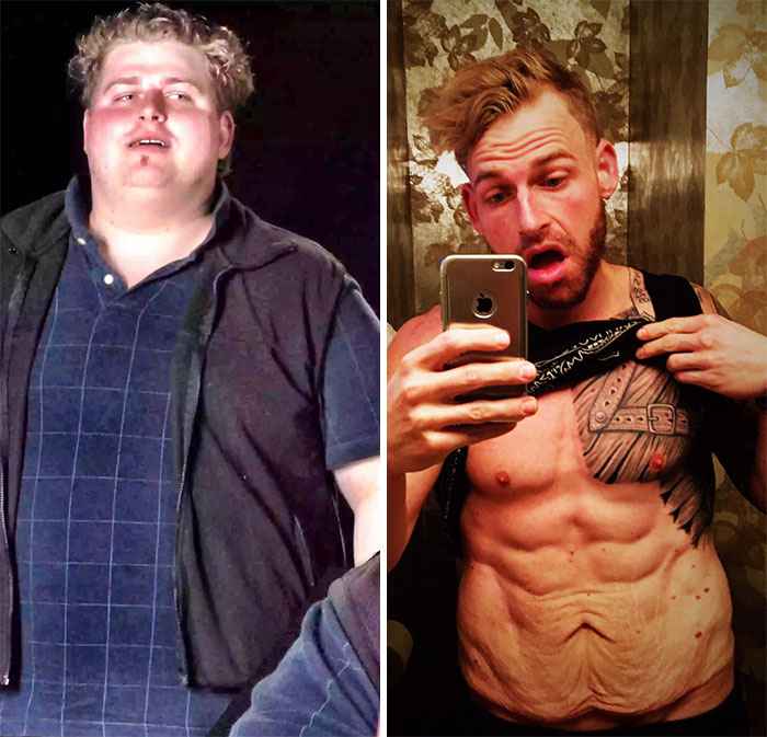 Before-And-After-Weight-Loss-Journey-1