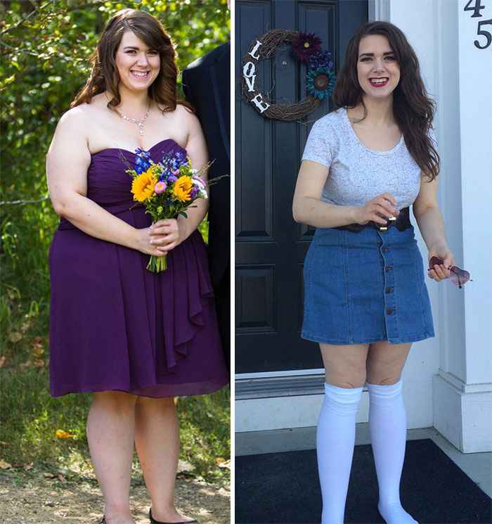 Before-And-After-Weight-Loss-Journey-2