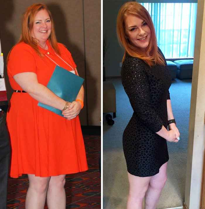 Before-And-After-Weight-Loss-Journey-3
