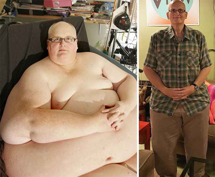 Before-And-After-Weight-Loss-Journey-7